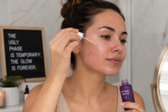 Woman applying retinol serum to face during the retinol ugly phase skin adjustment period
